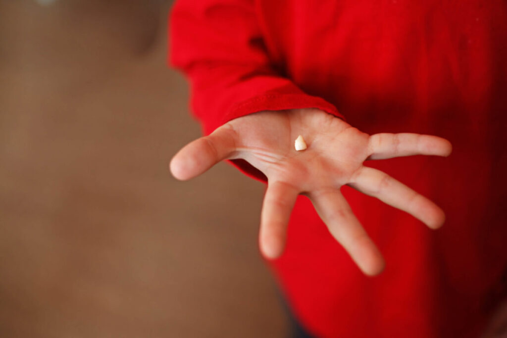 Teeth on the boy hand