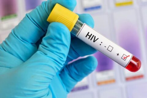 HIV checking tube