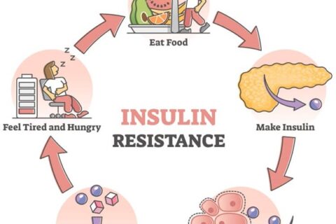 chart of insulin resistance